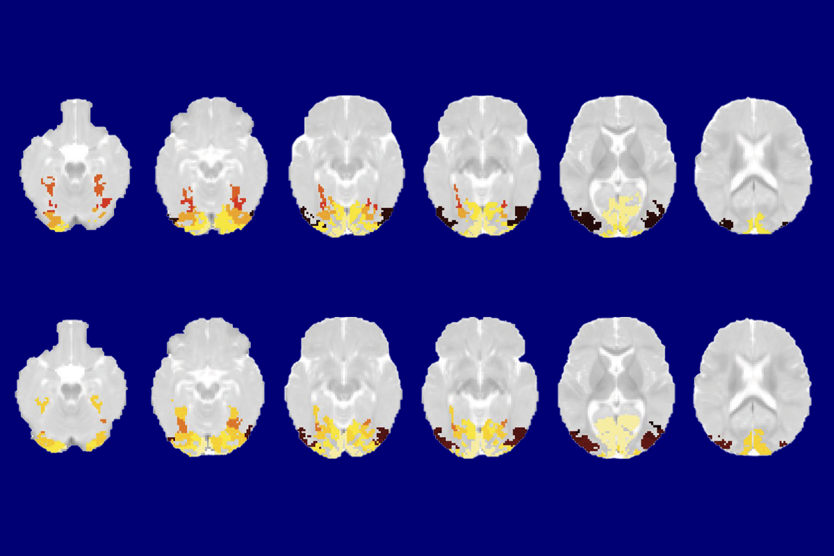 Unlike adults, 2-month-old infants (top row) show no evidence of visual categorization within the lateral occipitotemporal complex (black areas), although 9-month-olds (bottom row) show a little bit (maroon).