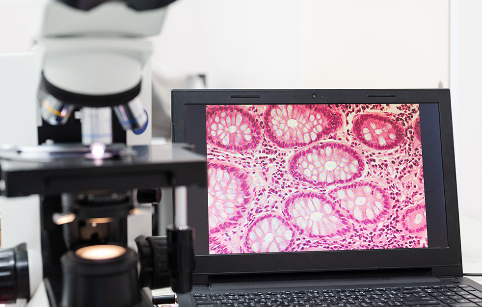 Computer screen with a microscopic histology slide next to a microscope