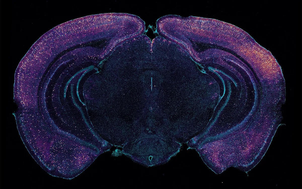 Microscope image of animal brain