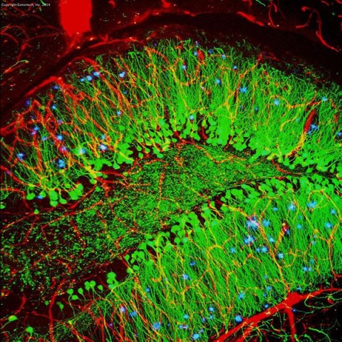 https://neuro.gatech.edu/sites/default/files/Hg_News/1-17-alz-fig-amyloid_0.jpg