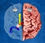 https://neuro.gatech.edu/sites/default/files/Hg_News/thumbs/Deep_Brain_Stimulation.jpg