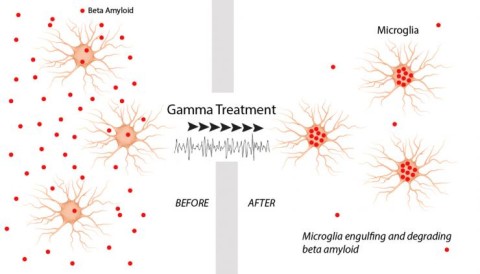 https://neuro.gatech.edu/sites/default/files/Hg_News/Microglia-beta_amyloid_cleanup-v2-01.jpg