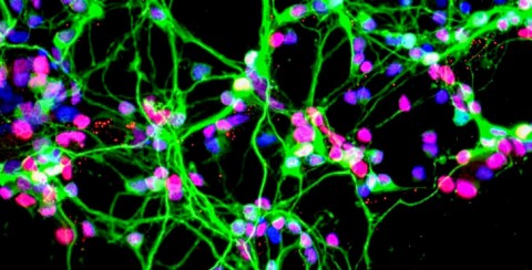 Neurons growing in a culture dish (NASA) Neurons growing in a culture dish (NASA)