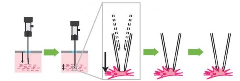https://neuro.gatech.edu/sites/default/files/Hg_News/autopatching_schematic_hires_0_0.jpg https://neuro.gatech.edu/sites/default/files/Hg_News/autopatching_schematic_hires_0_0.jpg