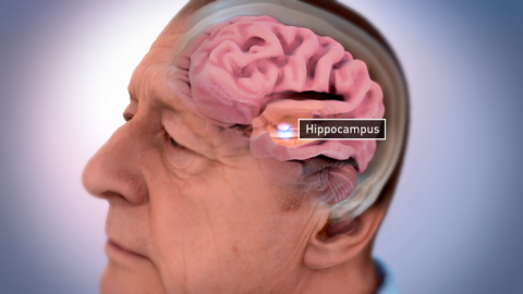 https://neuro.gatech.edu/sites/default/files/Hg_News/brain_shrink_hippocampus_0.jpg https://neuro.gatech.edu/sites/default/files/Hg_News/brain_shrink_hippocampus_0.jpg