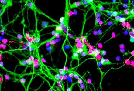 Neurons growing in a culture dish (NASA) Neurons growing in a culture dish (NASA)