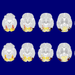 Unlike adults, 2-month-old infants (top row) show no evidence of visual categorization within the lateral occipitotemporal complex (black areas), although 9-month-olds (bottom row) show a little bit (maroon).