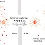 Gamma oscillation brain waves suppressed beta amyloid production and invigorated microglia