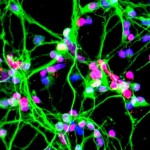 Neurons growing in a culture dish (NASA)
