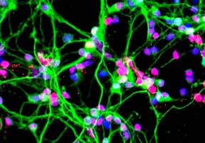 Neurons growing in a culture dish (NASA)