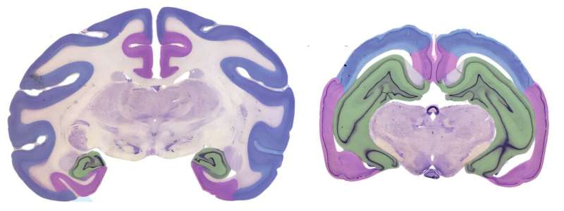 The myth of the 'lizard brain' and the real trade-off inside your mind